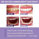 Toothpaste for Teeth Whitening (30ml)