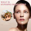 Topicals Faded Serum for Dark Spots